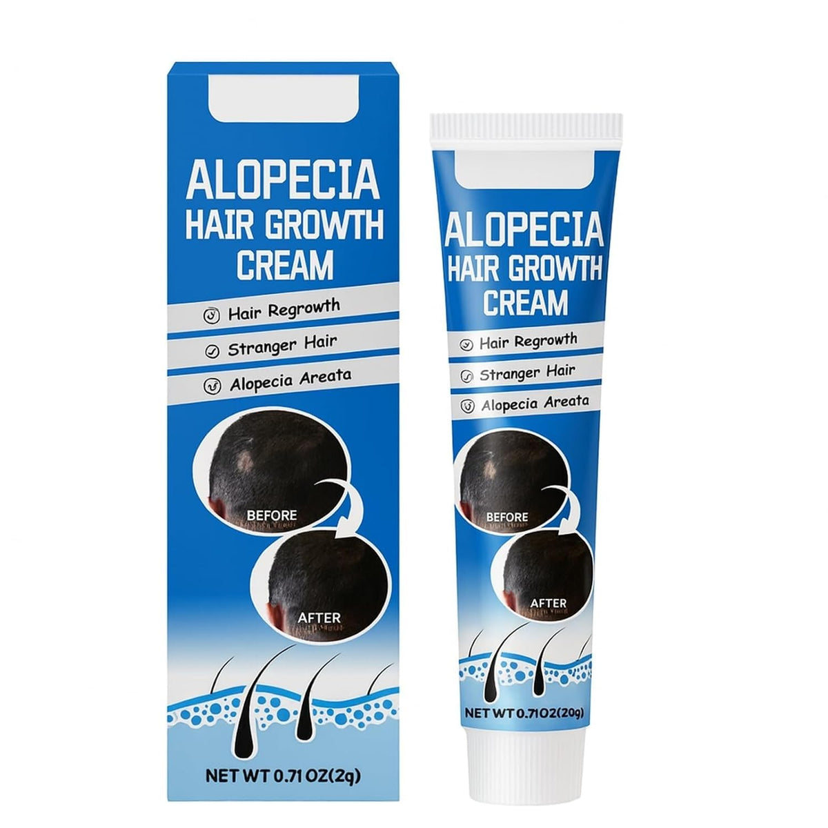 Alopecia Hair Growth Cream