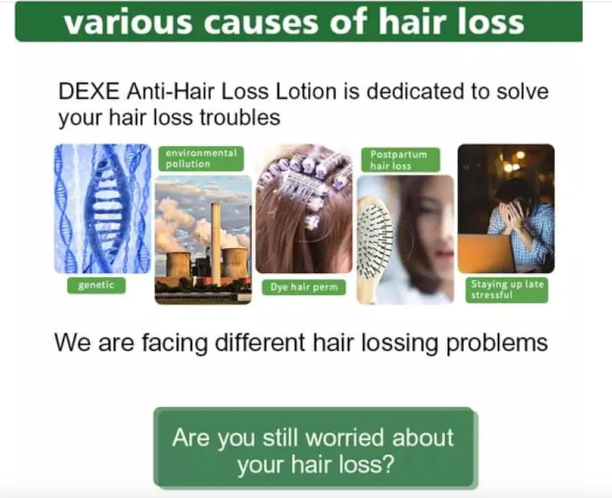 DeXe Anti Hair Loss Lotion 120ml | Hair Treatment Serum for Thinning Hair | Nourishes Scalp & Hair Roots | Strengthens Hair for Men & Women