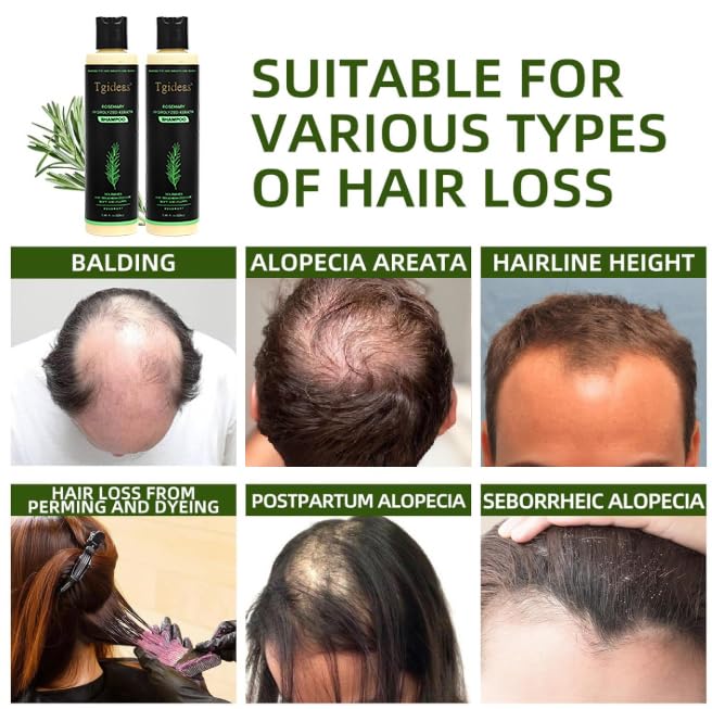 Tgideas Rosemary Biotin Volumizing Shampoo for Thinning Hair, 7.4 Fl Oz
