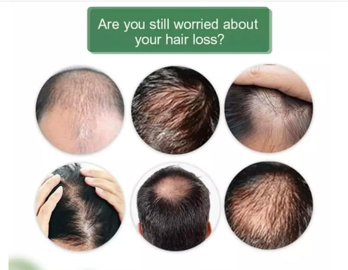 DeXe Anti Hair Loss Lotion 120ml | Hair Treatment Serum for Thinning Hair | Nourishes Scalp & Hair Roots | Strengthens Hair for Men & Women