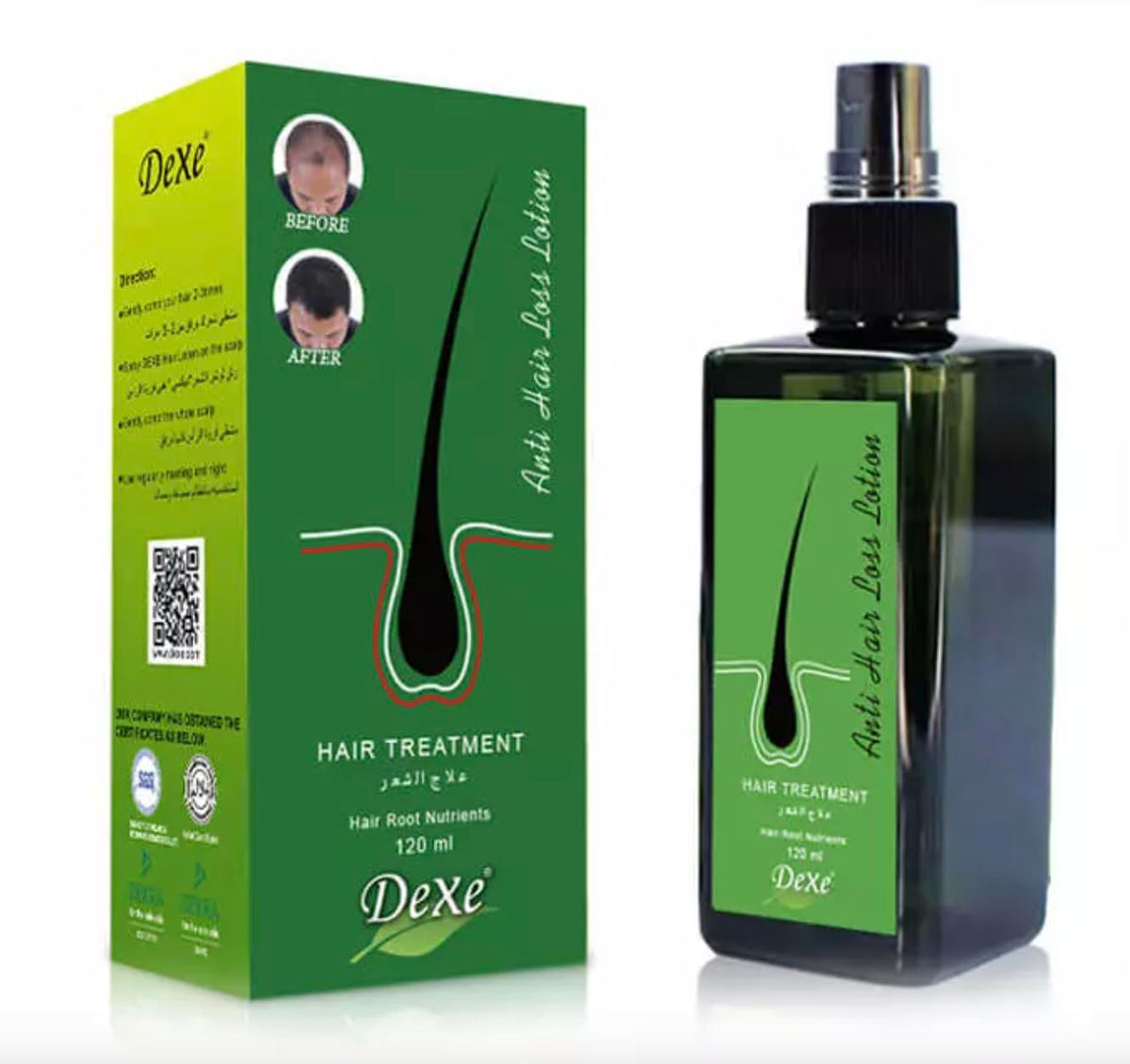 DeXe Anti Hair Loss Lotion 120ml | Hair Treatment Serum for Thinning Hair | Nourishes Scalp & Hair Roots | Strengthens Hair for Men & Women