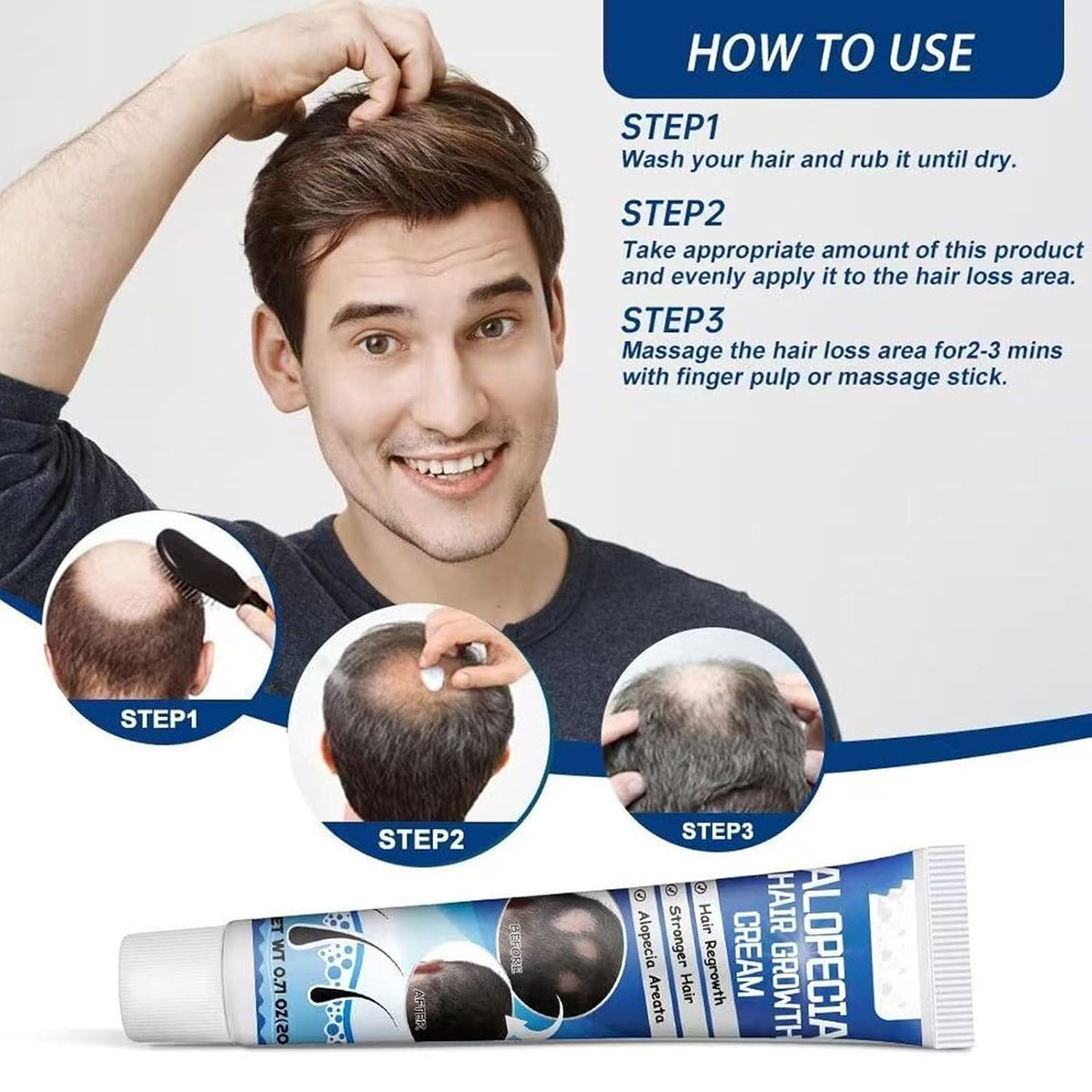 Alopecia Hair Growth Cream