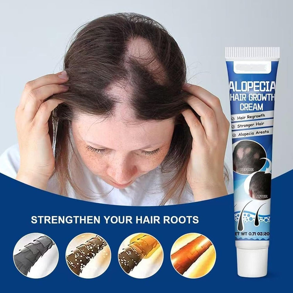 Alopecia Hair Growth Cream
