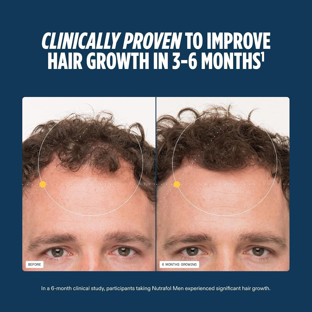 Nutrafol Men Hair Growth Supplements, Ages 18-49, 2-Month Pouches