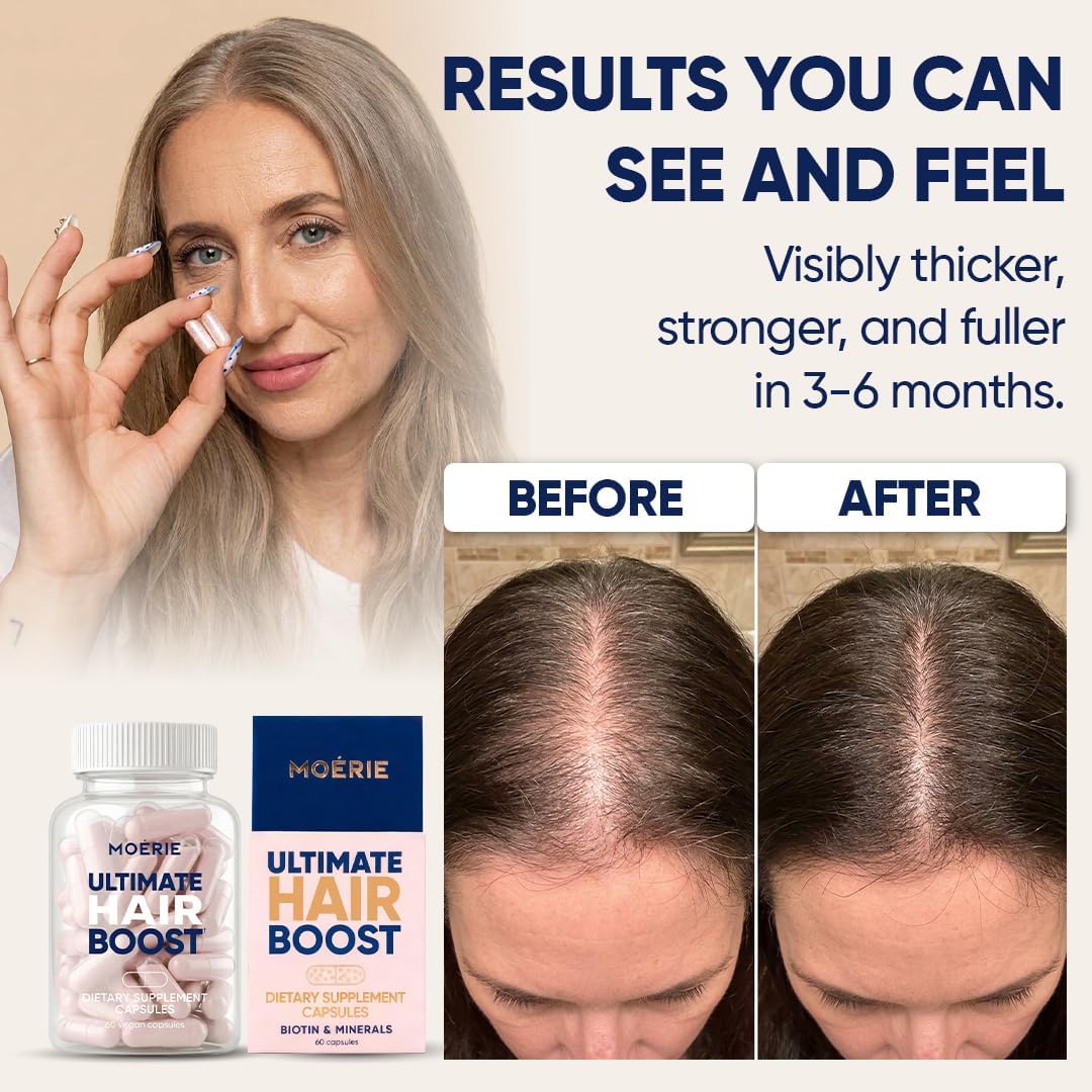 Moerie Ultimate Hair Boost Supplements for Women & Men - Hair, Skin, Nails Vitamins with Biotin & Minerals for Hair Health - Thicker Hair - 60 Capsules