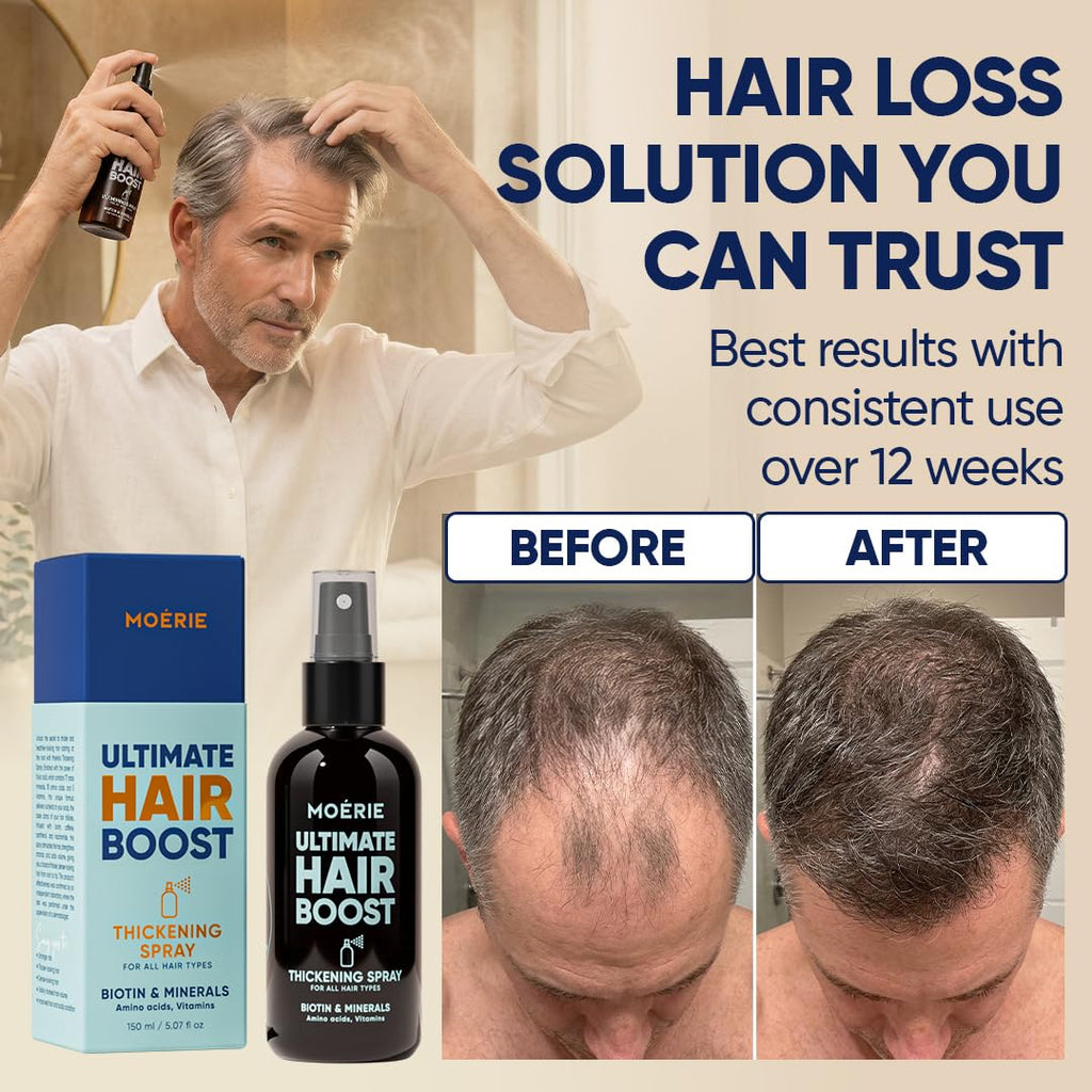 Moerie Hair Growth Serum Spray for Men and Women, Hair Loss Solution with Biotin and Rosemary, Thickening Serum for Hair Regrowth and Thinning Hair - Ultimate Scalp and Growth Care