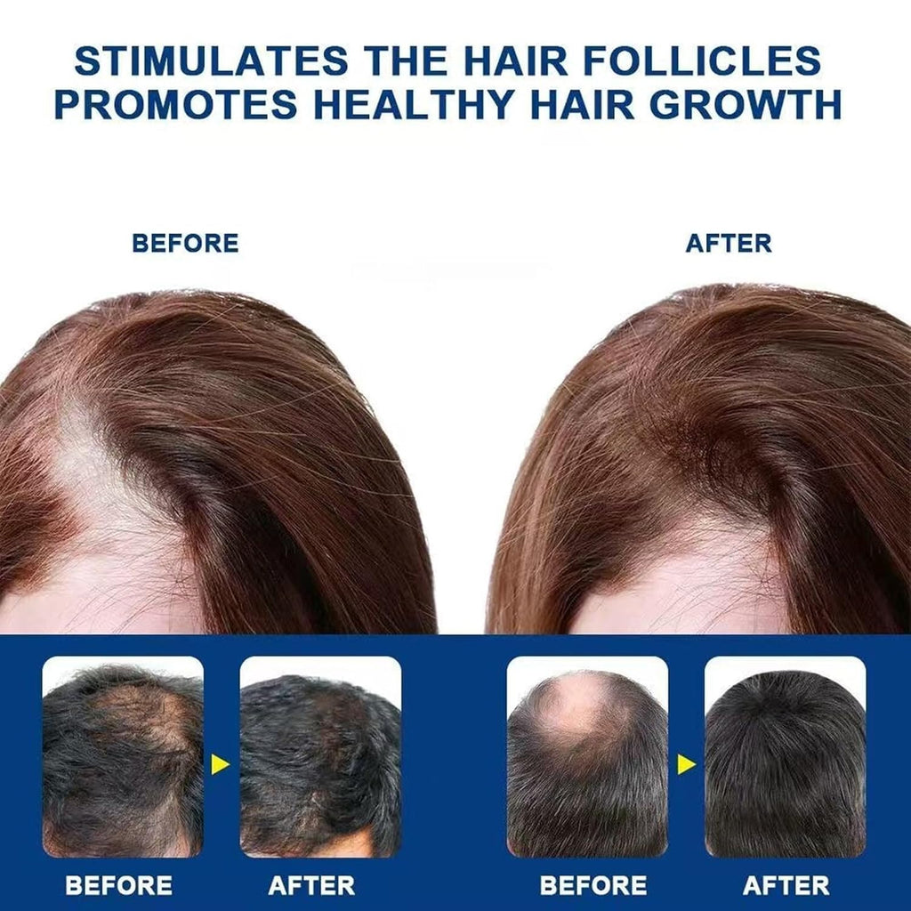 Alopecia Hair Growth Cream