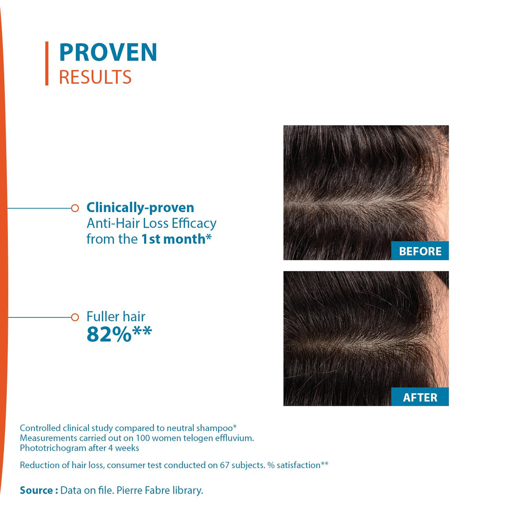 Ducray Creastim Reactiv Hair Loss Lotion 60 ml
