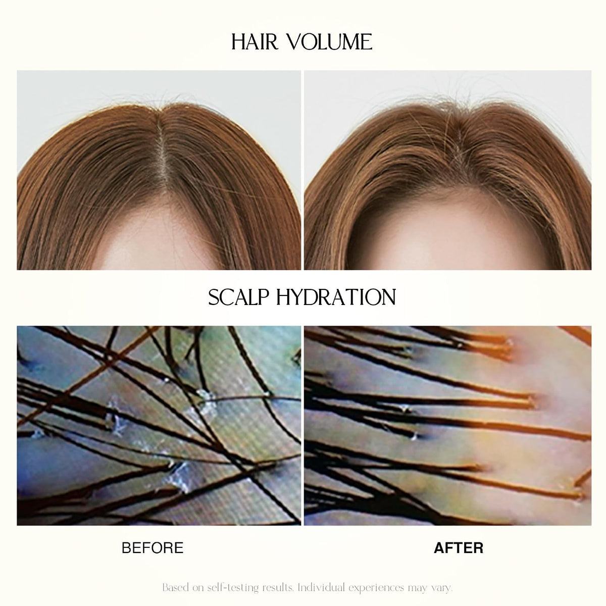 Mild Moisture Shampoo | Hydrating & Nourishing for Normal to Dry Scalp, Dermatologically Tested, Free from 12 Harsh Ingredients, Made in Korea | 16.9 fl oz