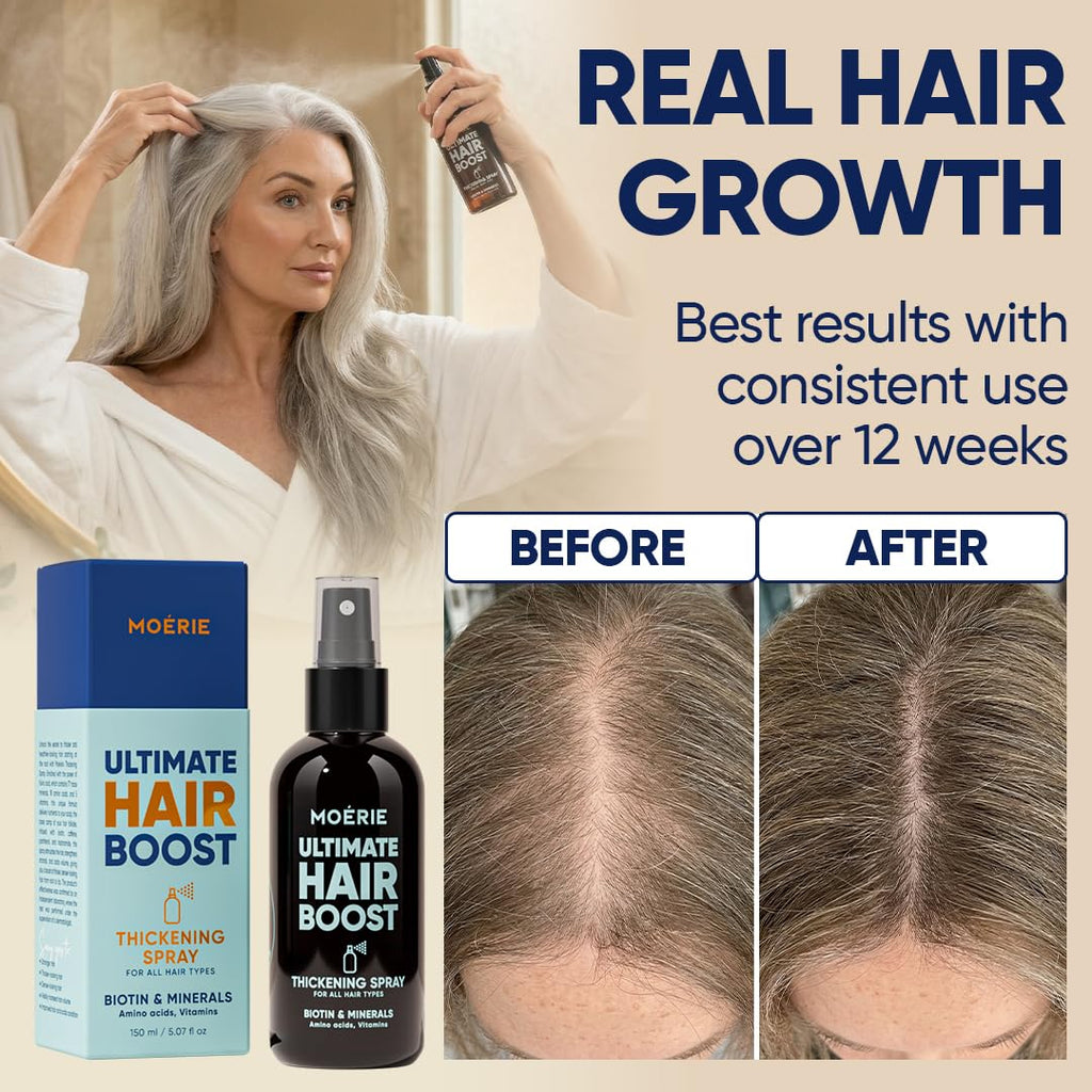 Moerie Hair Growth Serum Spray for Men and Women, Hair Loss Solution with Biotin and Rosemary, Thickening Serum for Hair Regrowth and Thinning Hair - Ultimate Scalp and Growth Care