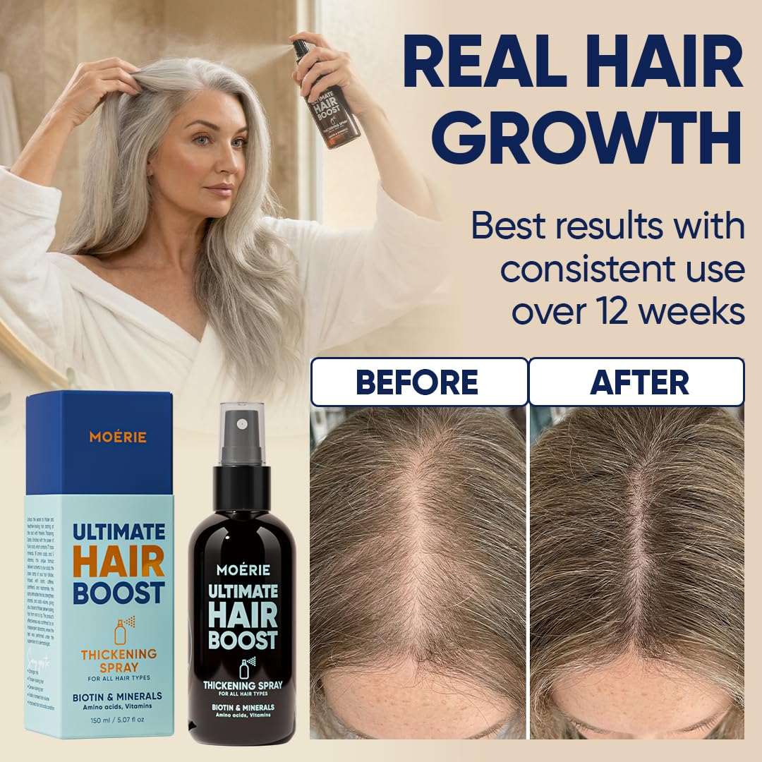 Moerie Hair Growth Serum Spray for Men and Women, Hair Loss Solution with Biotin and Rosemary, Thickening Serum for Hair Regrowth and Thinning Hair - Ultimate Scalp and Growth Care