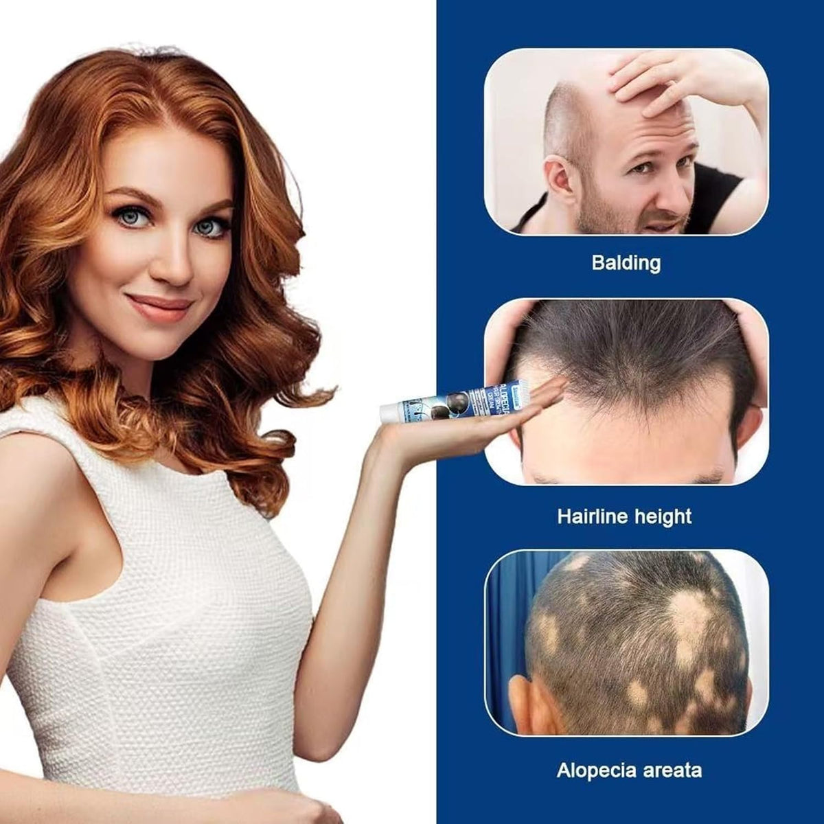 Alopecia Hair Growth Cream