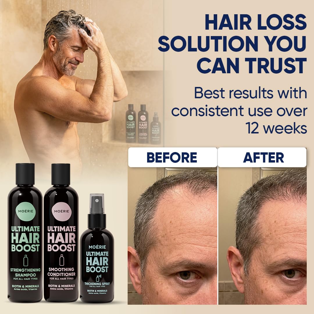 Moerie Hair Growth Shampoo, Conditioner and Spray for Men and Women, Hair Loss Solution with Biotin and Rosemary, Thickening Hair Regrowth Set with Serum Level Care for Thinning Hair