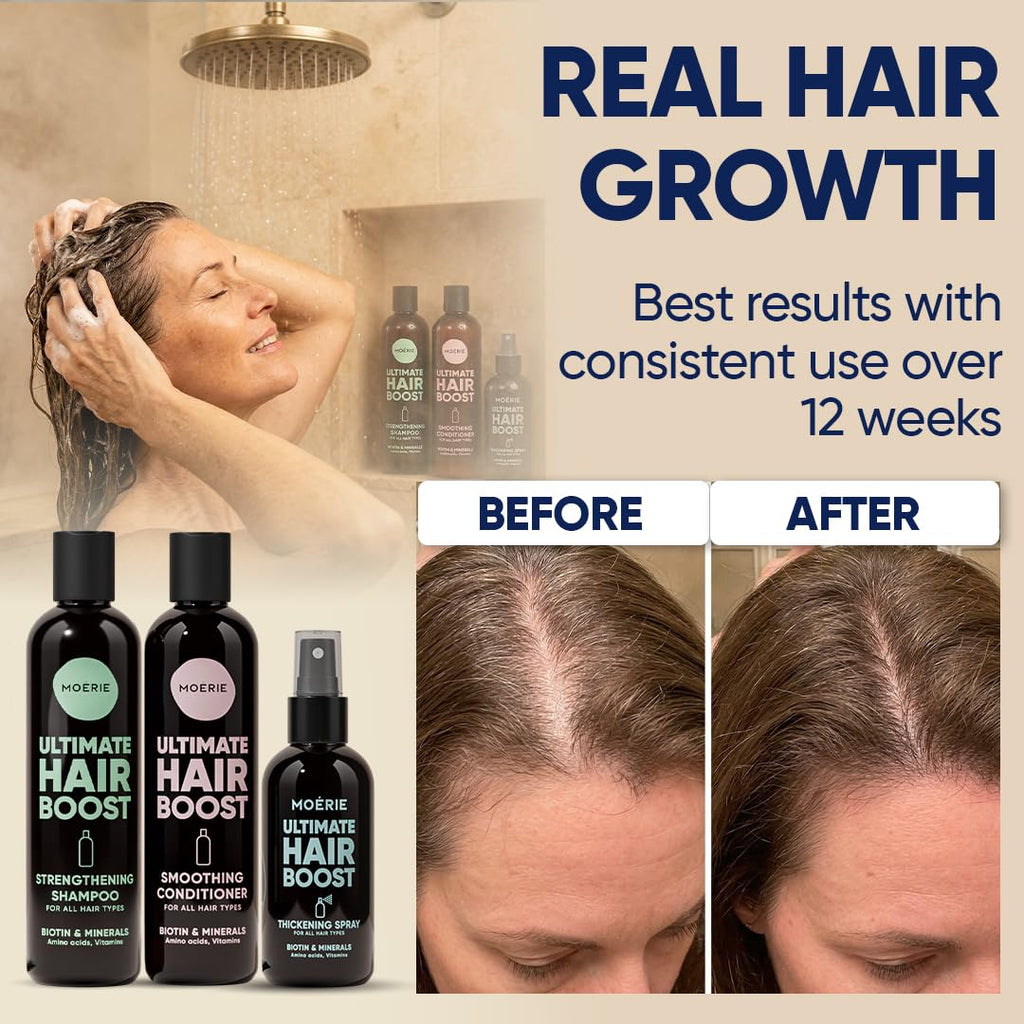 Moerie Hair Growth Shampoo, Conditioner and Spray for Men and Women, Hair Loss Solution with Biotin and Rosemary, Thickening Hair Regrowth Set with Serum Level Care for Thinning Hair
