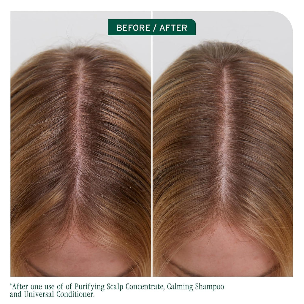 Biolage Scalp Sync Universal Conditioner – For All Scalp Types