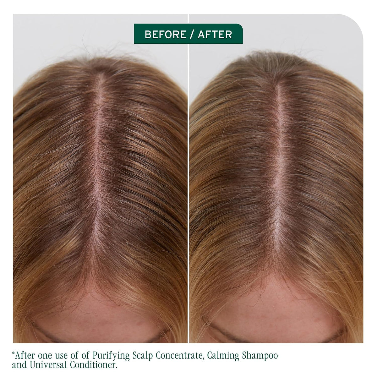 Biolage Scalp Sync Universal Conditioner – For All Scalp Types