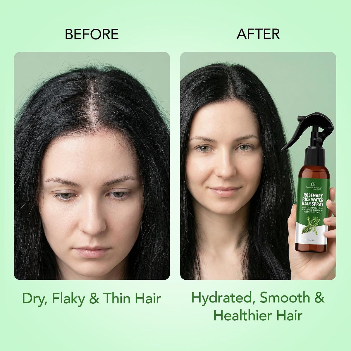 Botanic Hearth Rosemary & Rice Water Hair Growth Spray - 6.8 Fl oz