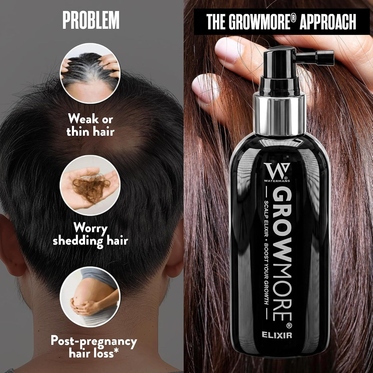 Grow More® Elixir – Leave In Hair Growth Serum for Thicker-Looking Hair & Improved Scalp Condition with Biotin, Caffeine, Rosemary & More – Sulfate-Free Hair Oil for Women & Men, 100mL